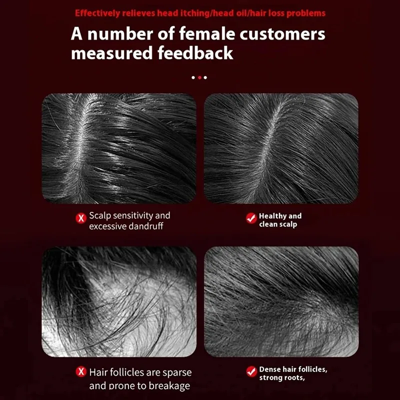 Electric Vibration Massage Com - Scalp Massager Electric recension och pris
